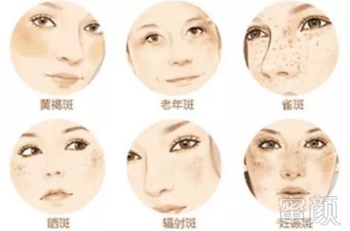 https://img.miyanlife.com/mnt/timg/181128/1212595P8-10.jpg