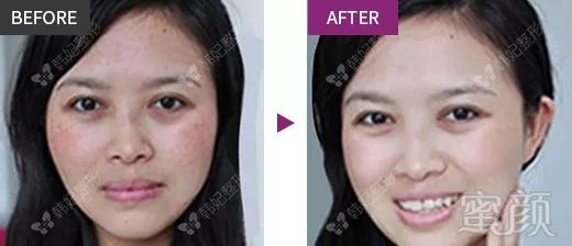 https://img.miyanlife.com/mnt/timg/181128/12125WE7-6.jpg