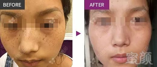 https://img.miyanlife.com/mnt/timg/181128/12125a2J-11.jpg