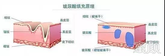 https://img.miyanlife.com/mnt/timg/181128/1215453315-0.jpg