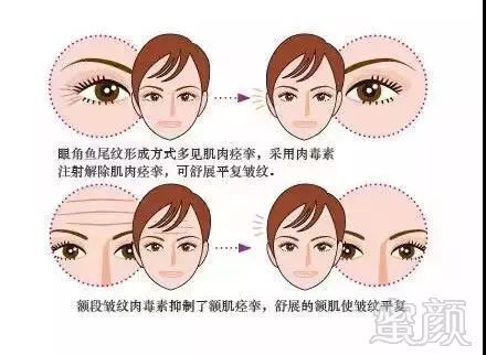https://img.miyanlife.com/mnt/timg/181128/121545L23-1.jpg