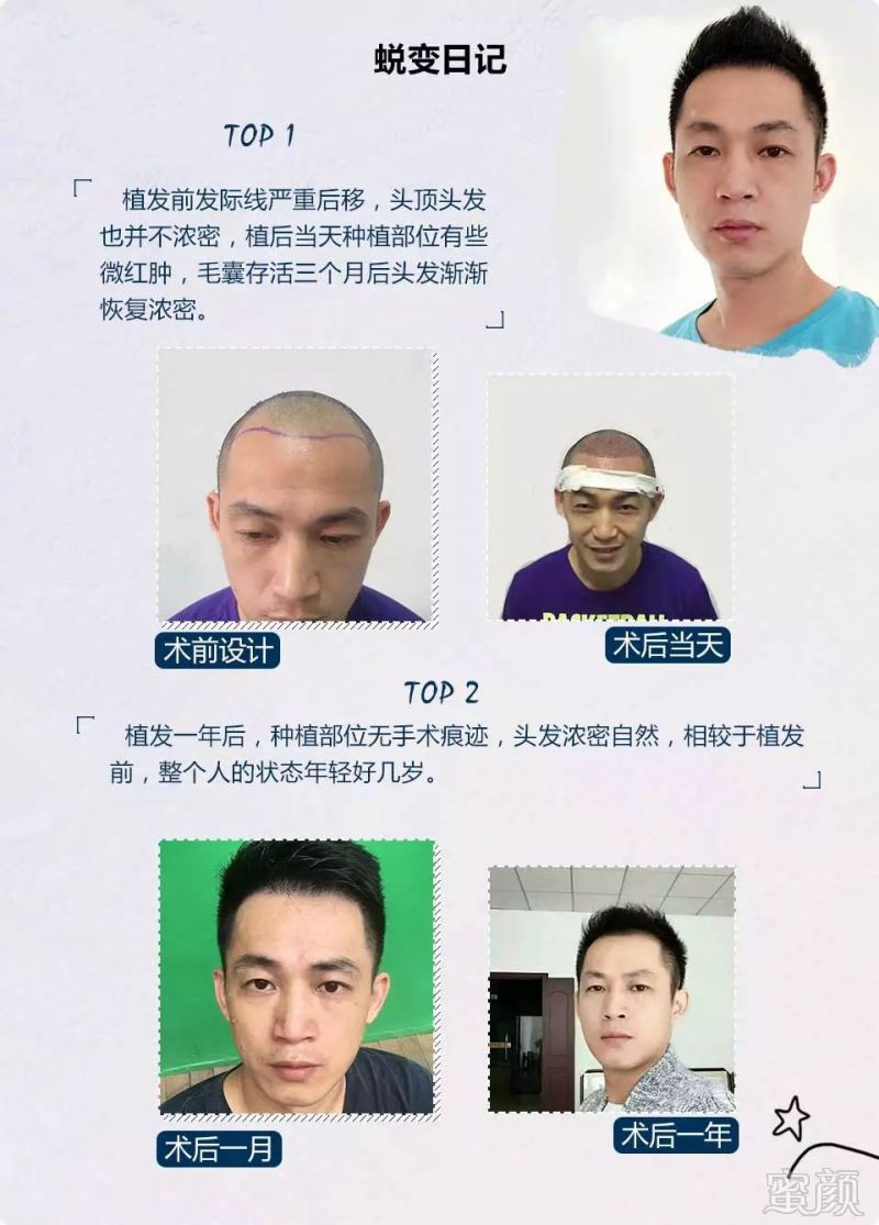 https://img.miyanlife.com/mnt/timg/181128/1219494642-8.jpg
