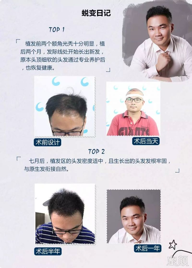 https://img.miyanlife.com/mnt/timg/181128/12194Q0G-6.jpg
