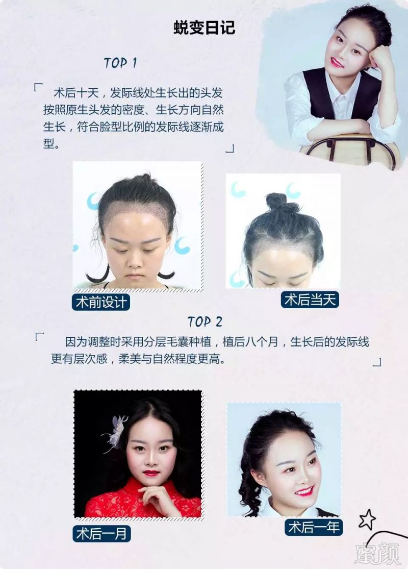 https://img.miyanlife.com/mnt/timg/181128/12194aZ9-7.jpg