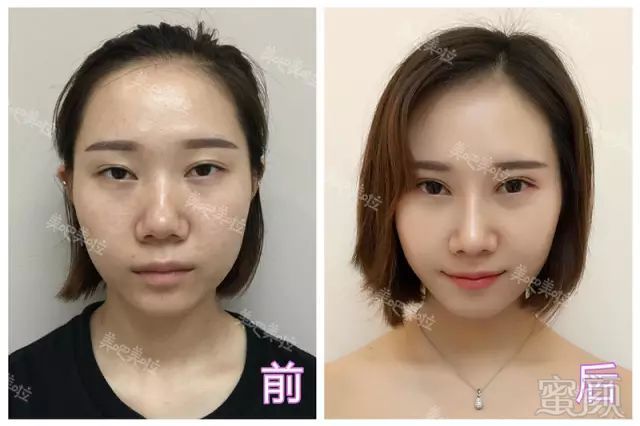 https://img.miyanlife.com/mnt/timg/181128/121U92H1-8.jpg