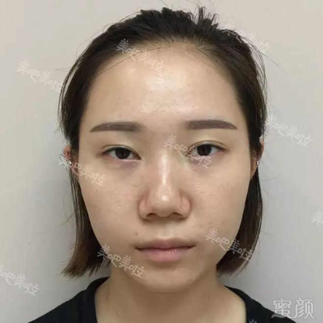 https://img.miyanlife.com/mnt/timg/181128/121U93N1-9.jpg
