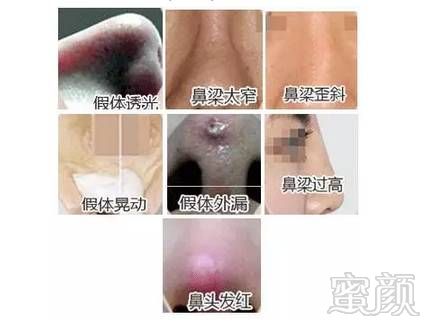 https://img.miyanlife.com/mnt/timg/181128/1220031231-4.jpg