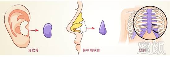https://img.miyanlife.com/mnt/timg/181128/1220032645-5.jpg