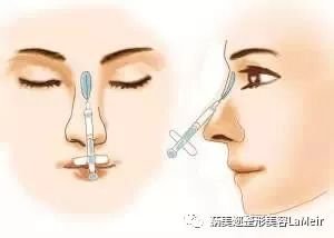 https://img.miyanlife.com/mnt/timg/181128/122J33408-2.jpg