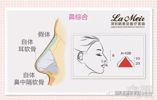 https://img.miyanlife.com/mnt/timg/181128/122J43104-8.jpg