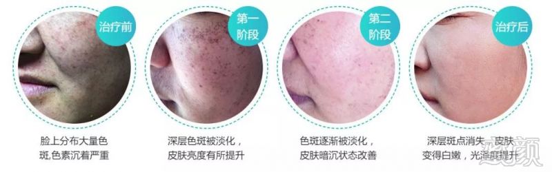 https://img.miyanlife.com/mnt/timg/181128/12341WE2-6.jpg