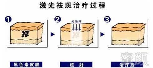 https://img.miyanlife.com/mnt/timg/181128/123543K26-1.jpg