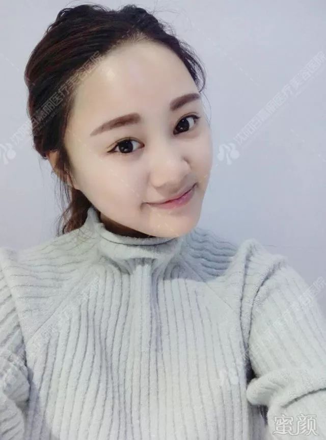 https://img.miyanlife.com/mnt/timg/181129/1043011110-2.jpg