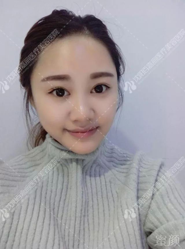 https://img.miyanlife.com/mnt/timg/181129/1043011B5-0.jpg