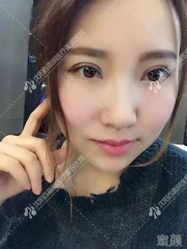 https://img.miyanlife.com/mnt/timg/181129/1043024A3-9.jpg