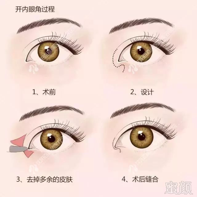 https://img.miyanlife.com/mnt/timg/181129/1043031348-12.jpg
