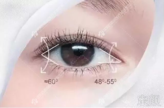 https://img.miyanlife.com/mnt/timg/181129/1043034550-15.jpg