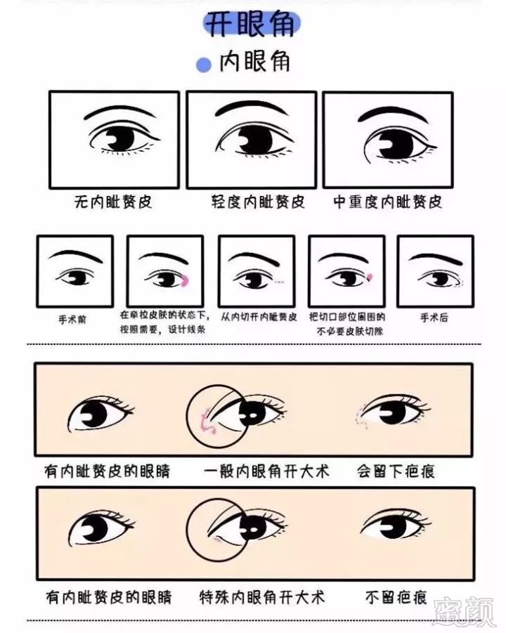 https://img.miyanlife.com/mnt/timg/181129/1102555435-0.jpg
