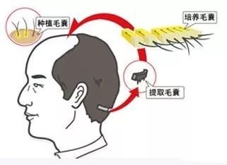 https://img.miyanlife.com/mnt/timg/181129/113QW1T-5.jpg