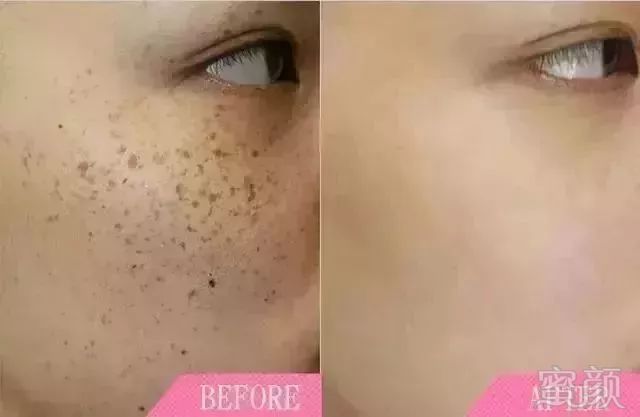 https://img.miyanlife.com/mnt/timg/181129/1144212025-5.jpg