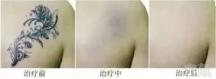 https://img.miyanlife.com/mnt/timg/181129/1144213919-6.jpg