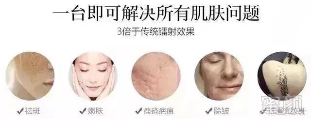 https://img.miyanlife.com/mnt/timg/181129/1144213P6-4.jpg