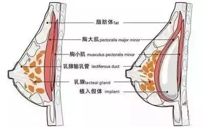 案例图片