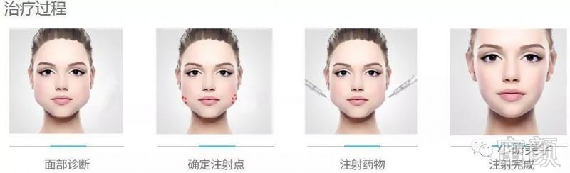 https://img.miyanlife.com/mnt/timg/181129/1220312K8-2.jpg