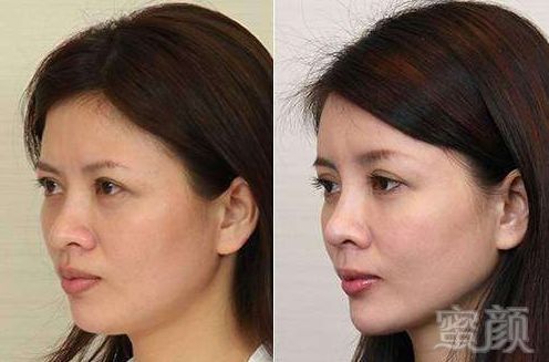 https://img.miyanlife.com/mnt/timg/181129/1221555K4-6.jpg