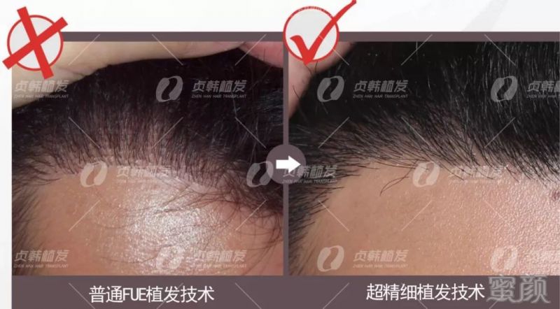 https://img.miyanlife.com/mnt/timg/181129/1225021327-2.jpg