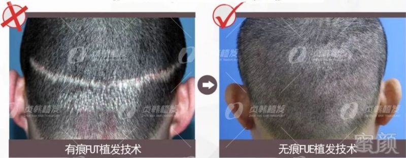 https://img.miyanlife.com/mnt/timg/181129/122502OI-4.jpg