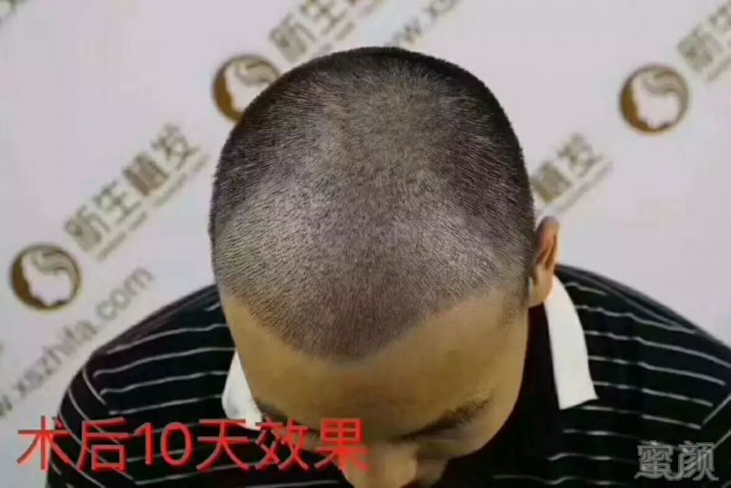 https://img.miyanlife.com/mnt/timg/181129/1225212251-2.jpg