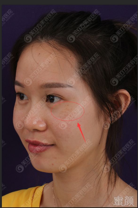 https://img.miyanlife.com/mnt/timg/181129/12403J463-3.jpg