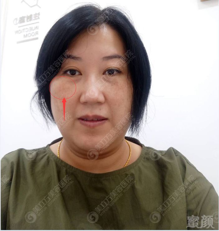 https://img.miyanlife.com/mnt/timg/181129/12403RU7-8.jpg