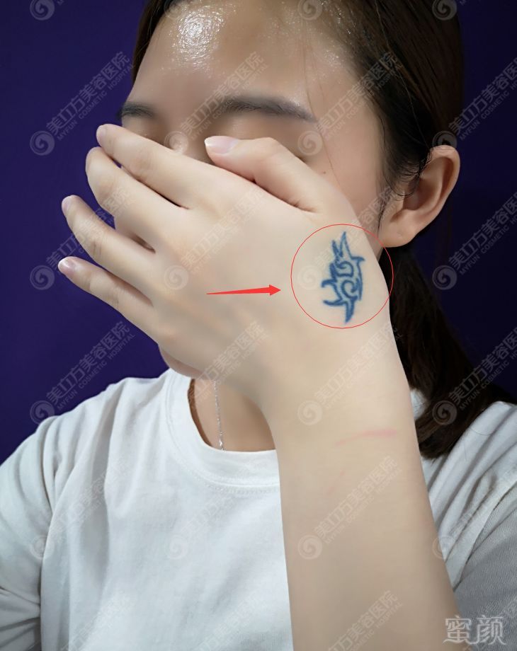 https://img.miyanlife.com/mnt/timg/181129/12403SR4-5.jpg