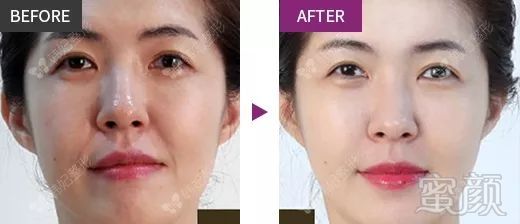 https://img.miyanlife.com/mnt/timg/181129/12431J394-12.jpg