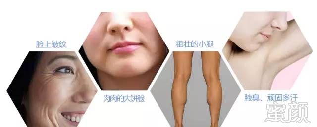 https://img.miyanlife.com/mnt/timg/181130/104051A22-2.jpg
