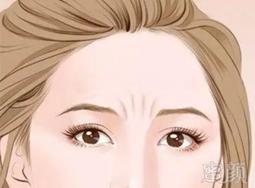 https://img.miyanlife.com/mnt/timg/181130/1040521324-3.jpg
