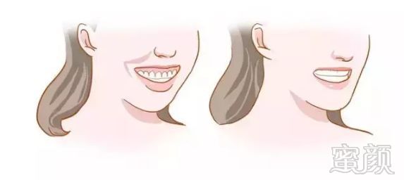 https://img.miyanlife.com/mnt/timg/181130/104052O12-7.jpg