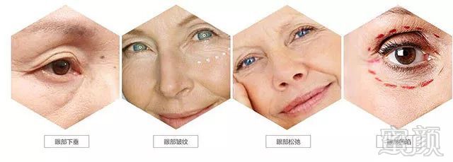 https://img.miyanlife.com/mnt/timg/181130/1046252A1-9.jpg