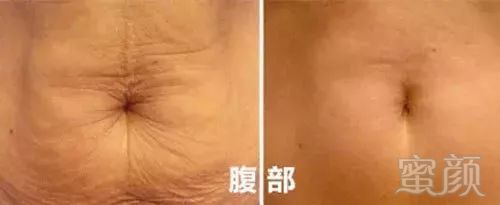 https://img.miyanlife.com/mnt/timg/181130/1046256117-10.jpg