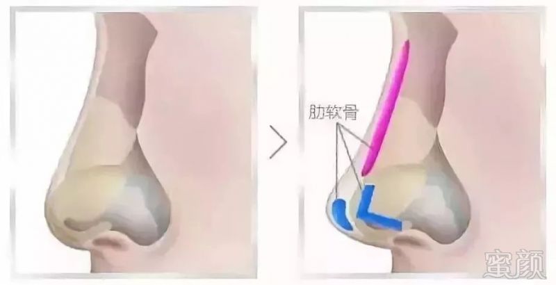 https://img.miyanlife.com/mnt/timg/181130/1056192520-6.jpg