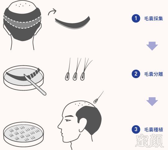 https://img.miyanlife.com/mnt/timg/181130/1151216318-3.jpg