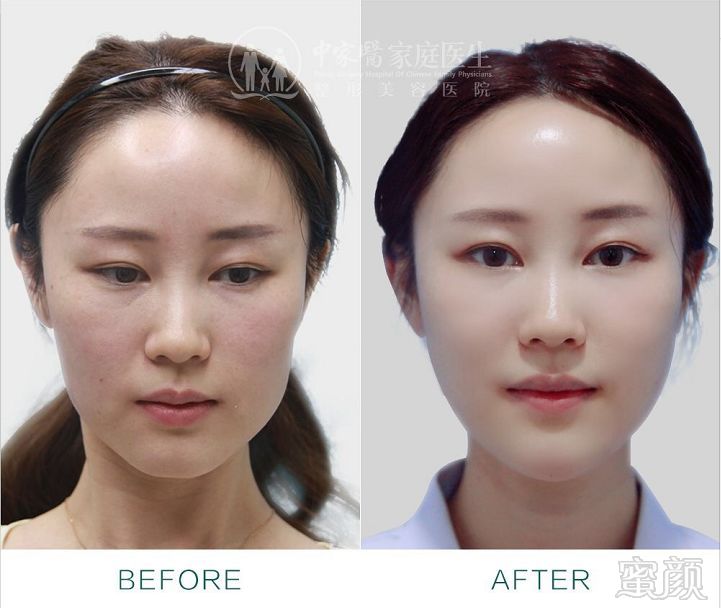 https://img.miyanlife.com/mnt/timg/181130/1214522H7-13.jpg