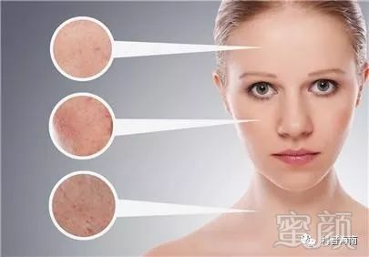 https://img.miyanlife.com/mnt/timg/181130/122220L22-0.jpg