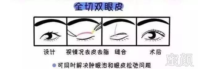 案例图片