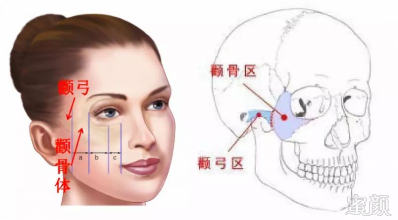 颧部图片