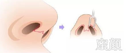 https://img.miyanlife.com/mnt/timg/181201/11154Q349-4.jpg