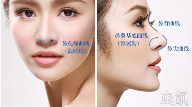 https://img.miyanlife.com/mnt/timg/181201/11154W208-1.jpg