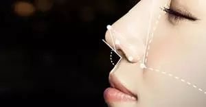 https://img.miyanlife.com/mnt/timg/181201/113R523S-1.jpg
